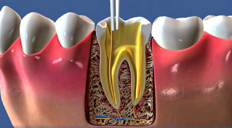Endodontia