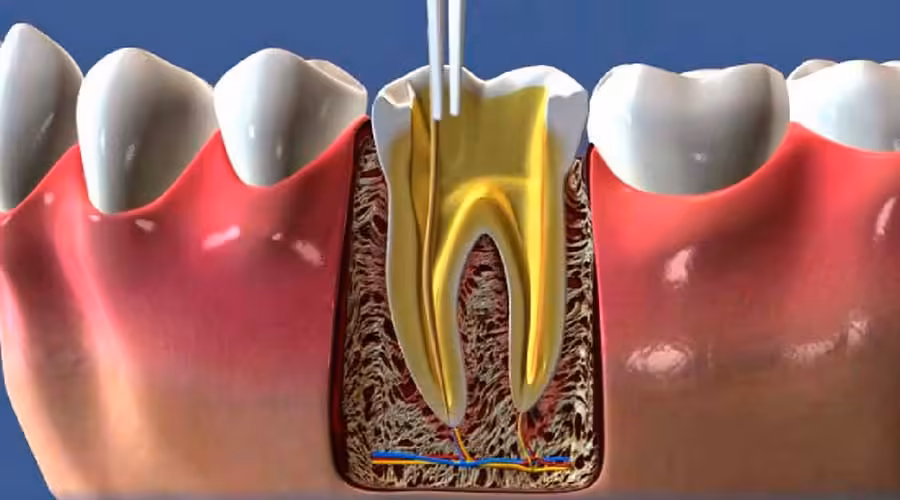Endodontia